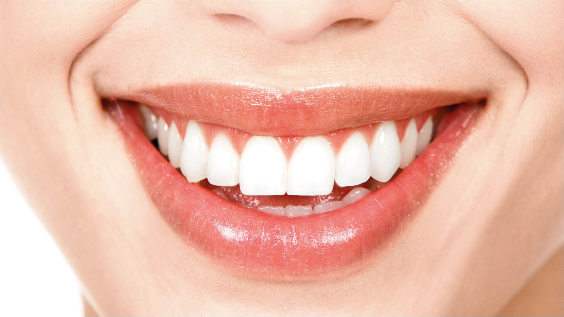 Limpieza dental profesional en Bogotá